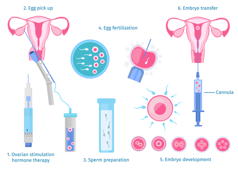 IVF Treatment